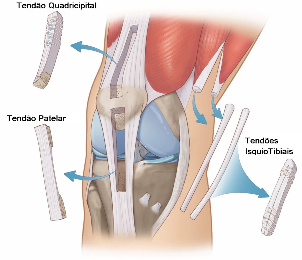 tendões posteriores do joelho
